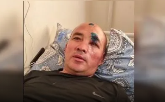 Пострадавший от взрыва в Жамбылской области военный рассказал, как остался жив