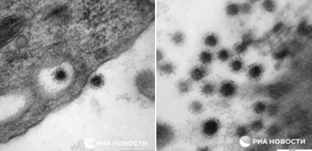 Появились фотографии дельта-штамма коронавируса